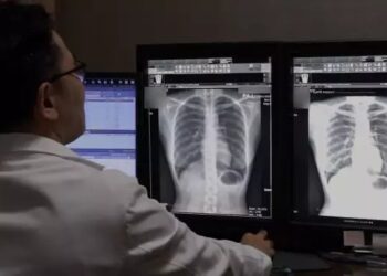 भारत में आ रहा ऐसा AI सिस्टम, जो X-Ray देखकर बता देगा बीमारी