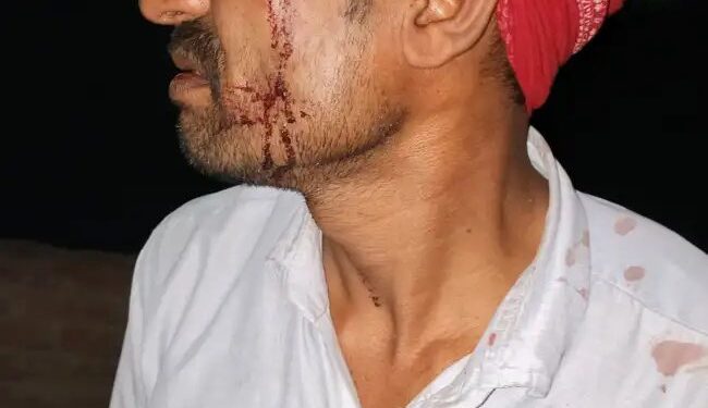 फ्यूज जोड़ने से मना किया तो संविदा कर्मी लाइन मैन की पिटाई