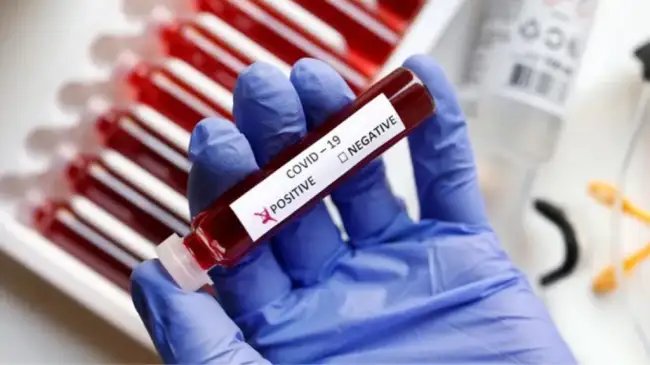 एक दिन में कोविड-19 से दूसरी मौत: स्वास्थ्य अधिकारियों ने सतर्कता बरतने का आग्रह किया